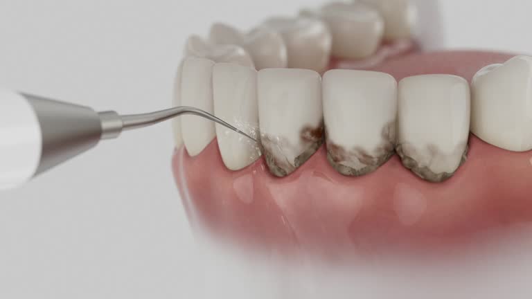 Trusted Teeth Cleaning And Checkup service in Brinkley, AR - Dentist Open Now